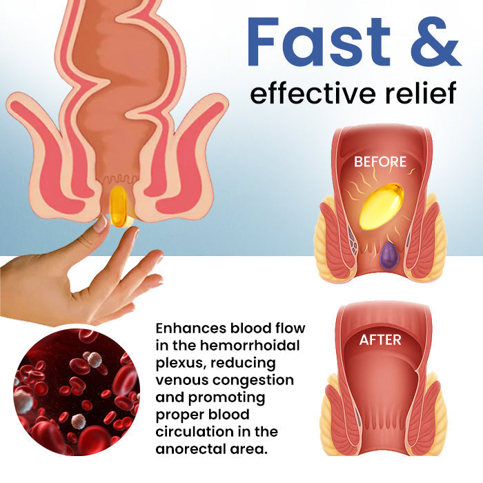 đ„LIMITED DEAL: 60% OFFđ„CvreozÂź Natural Hemorrhoid Capsules