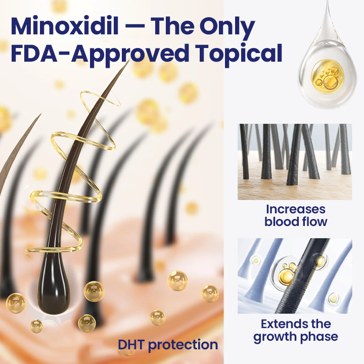 Limited Time Offer – 60% OFF Today Only! Cvreoz® Minoxidil Fast-Action Hair Growth Serum
