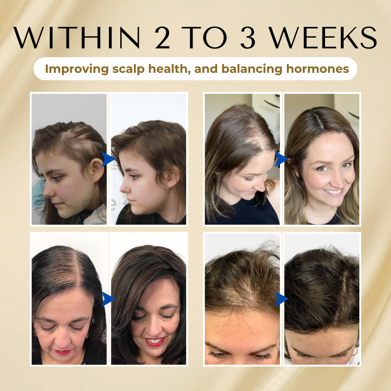 đ„ Grow Your Glow: 60% OFF đ„ CvreozÂź Biotin Hair Essential Oil!