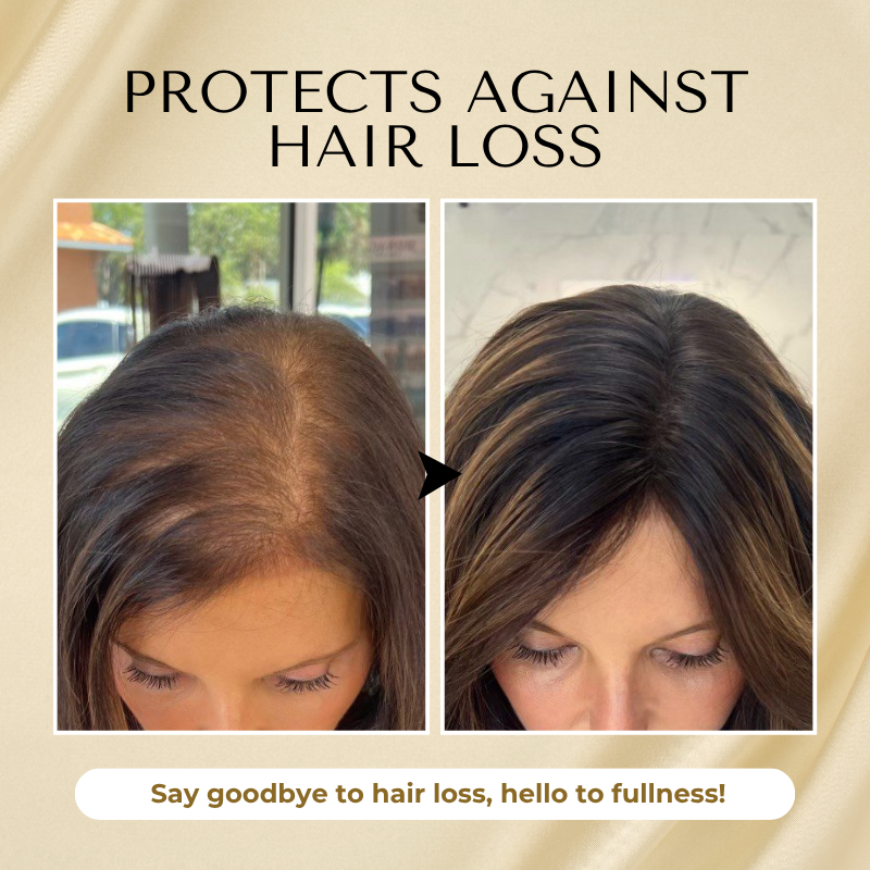 đ„ Grow Your Glow: 60% OFF đ„ CvreozÂź Biotin Hair Essential Oil!