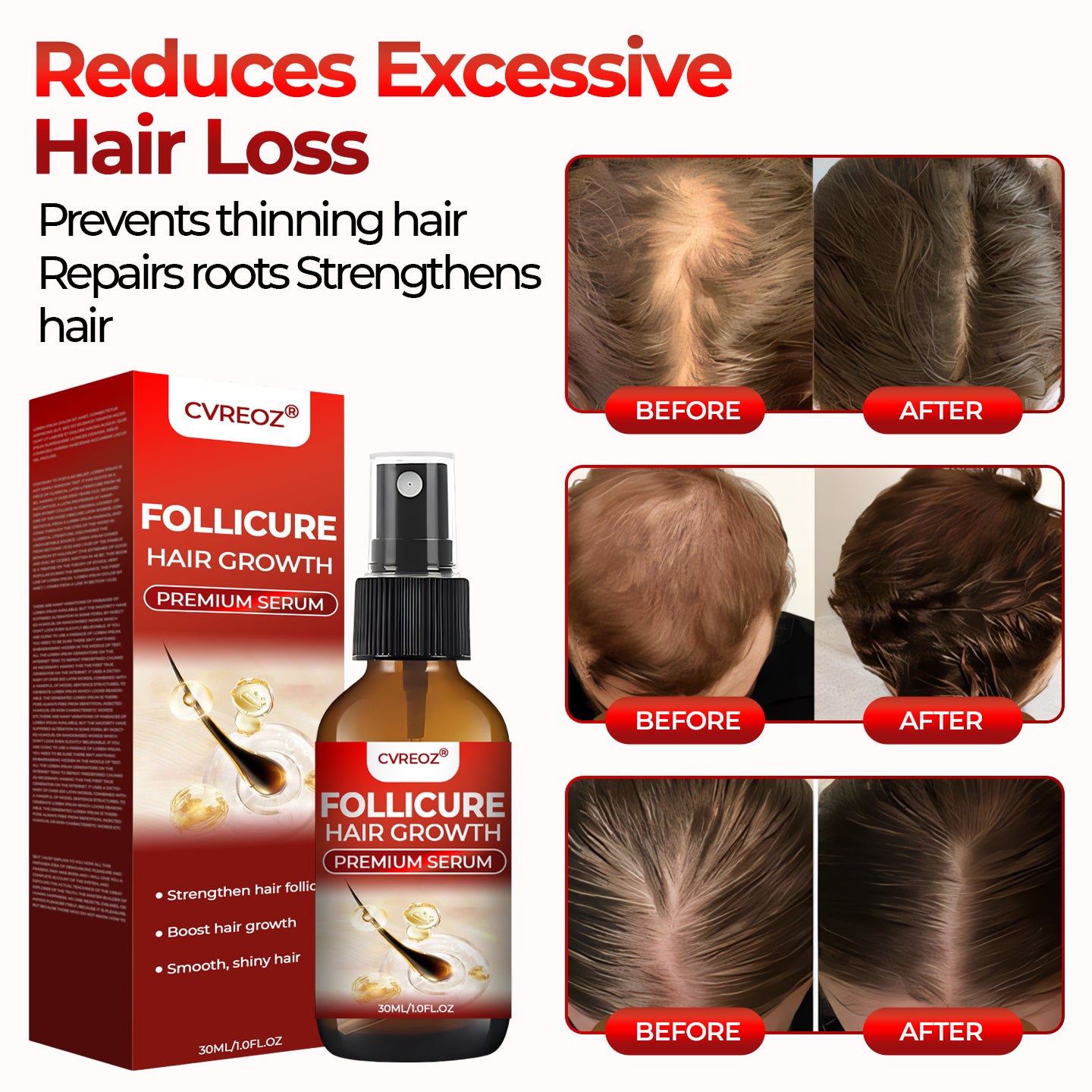 ❤️ CVREOZ® FolliCure Hair Growth Premium Serum 🔥 LIMITED OFFER 60%🔥