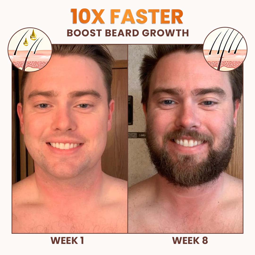 LIMITED TIME SALE OFF 60%🔥Cvreoz® Premium Biotin Hair&Beard Booster
