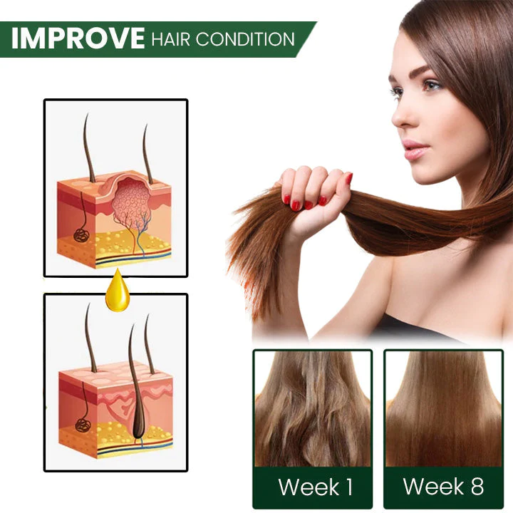 ⏰Last Day Promotion: 60% OFF🔥 Cvreoz® Shouga Essence Hair Growth Oil
