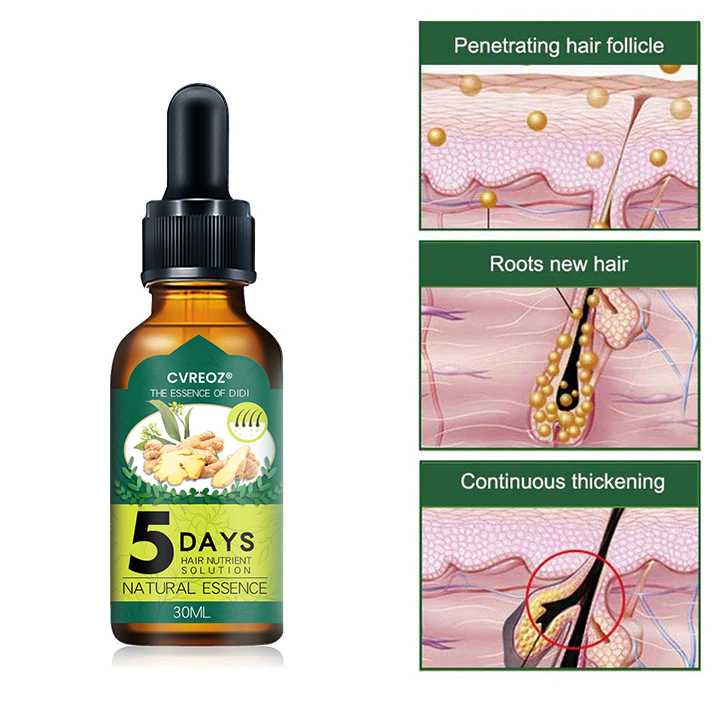 ⏰Last Day Promotion: 60% OFF🔥 Cvreoz® Shouga Essence Hair Growth Oil