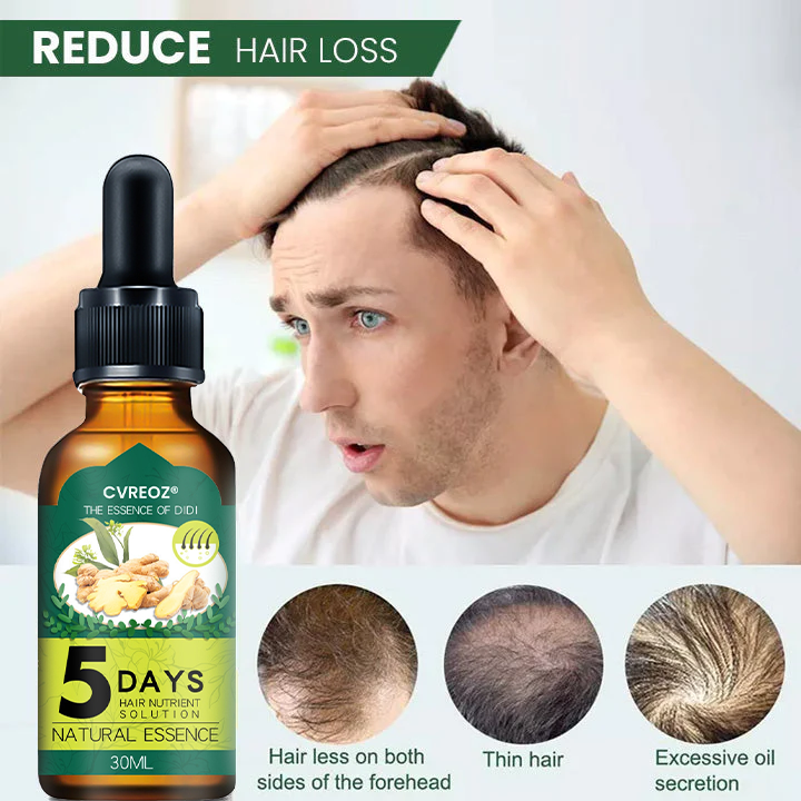 ⏰Last Day Promotion: 60% OFF🔥 Cvreoz® Shouga Essence Hair Growth Oil