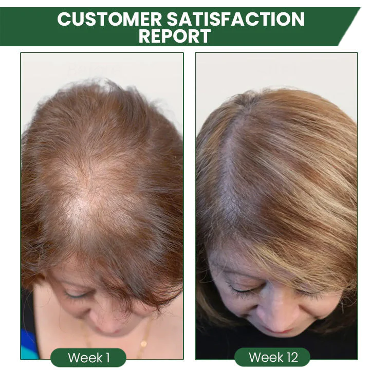 ⏰Last Day Promotion: 60% OFF🔥 Cvreoz® Shouga Essence Hair Growth Oil
