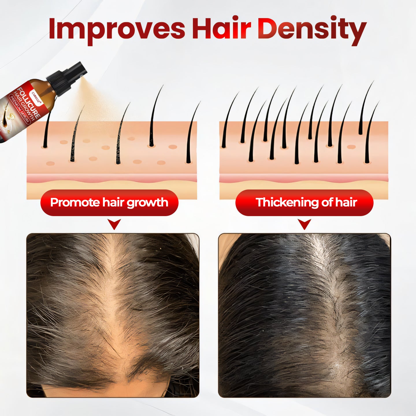 ❤️ CVREOZ® FolliCure Hair Growth Premium Serum 🔥 LIMITED OFFER 60%🔥