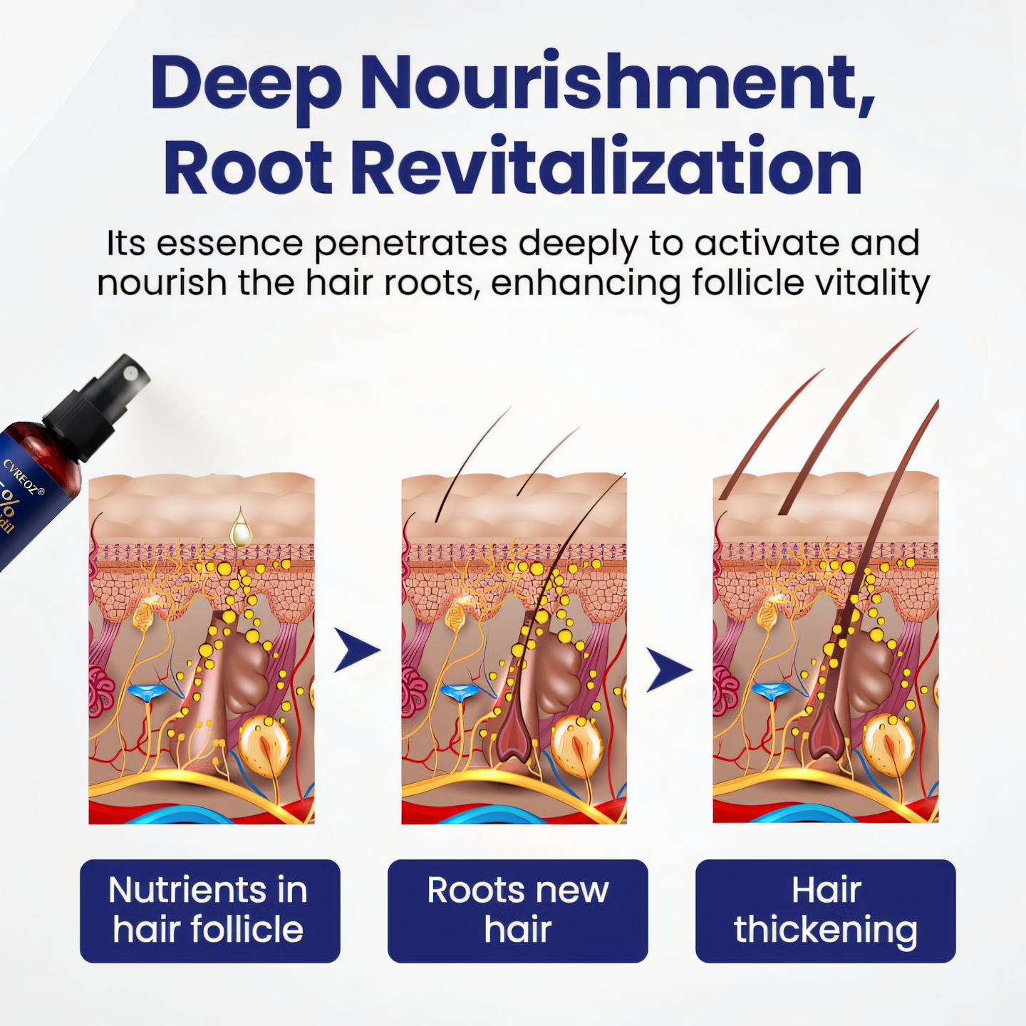 Limited Time Offer – 60% OFF Today Only! Cvreoz® Minoxidil Fast-Action Hair Growth Serum