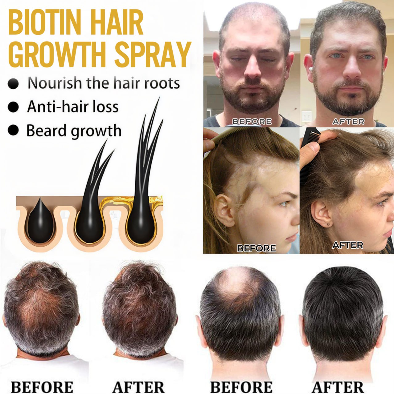 đ„ Grow Your Glow: 60% OFF đ„ CvreozÂź Biotin Hair Essential Oil!