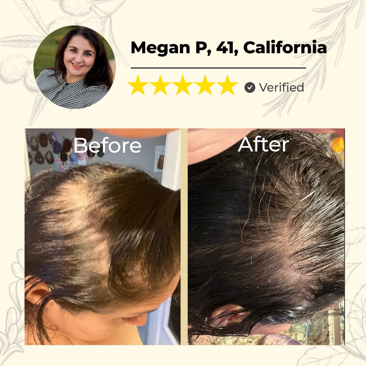 đ„60% OFF TODAY ONLYđ„CvreozÂź Natural Hair Growth Spray