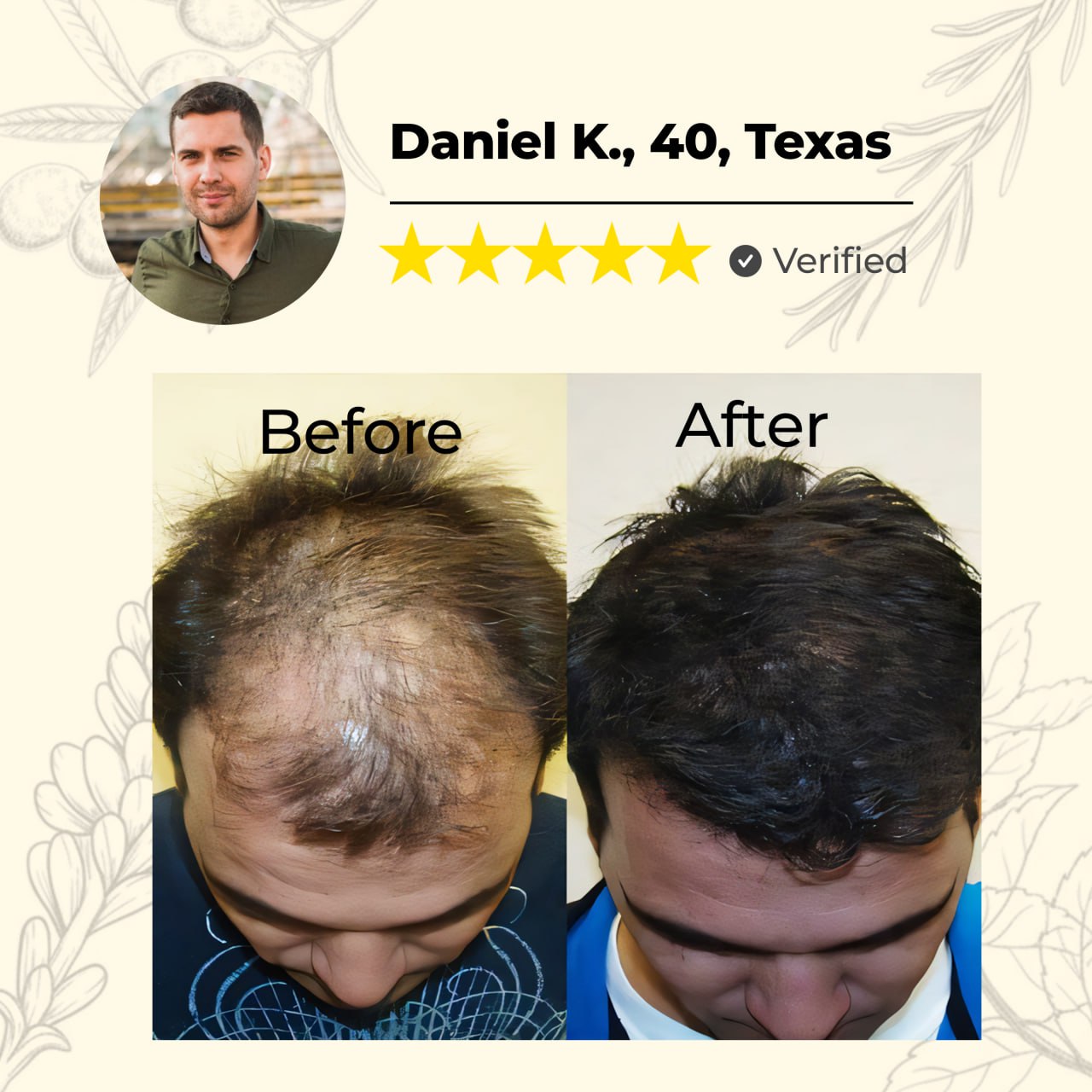 đ„60% OFF TODAY ONLYđ„CvreozÂź Natural Hair Growth Spray