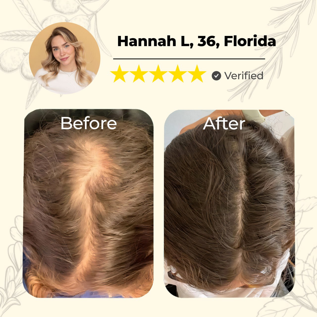 đ„60% OFF TODAY ONLYđ„CvreozÂź Natural Hair Growth Spray