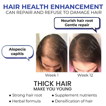 🔥 HOT SALE: 60% OFF🔥Cvreoz® ReVita Hair Growth Serum - Minoxidil Topical Solution USP, 5% with Biotin