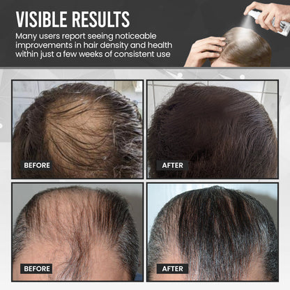 ⏰FLASH SALE: 60% OFF🔥Cvreoz® DermaThick Hair Growth Elixir