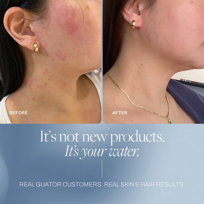 Billhol® Guator Shower Filter