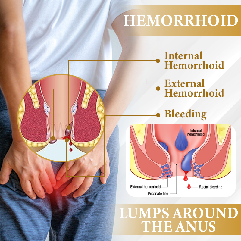 🔥 LIMITED OFFER: Sale up to 60%  🔥 Cvreoz® Apis Venom Hemorrhoid Cooling Spray