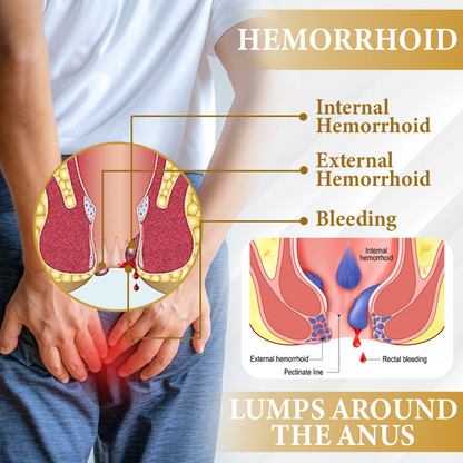 🔥 LIMITED OFFER: Sale up to 60%  🔥 Cvreoz® Apis Venom Hemorrhoid Cooling Spray