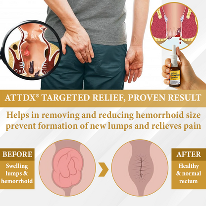 🔥 LIMITED OFFER: Sale up to 60%  🔥 Cvreoz® Apis Venom Hemorrhoid Cooling Spray