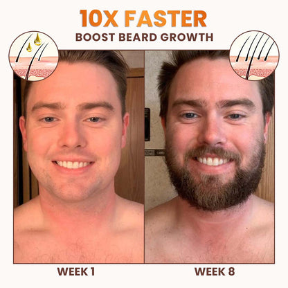 LIMITED TIME SALE OFF 60%🔥Cvreoz® Premium Biotin Hair&Beard Booster