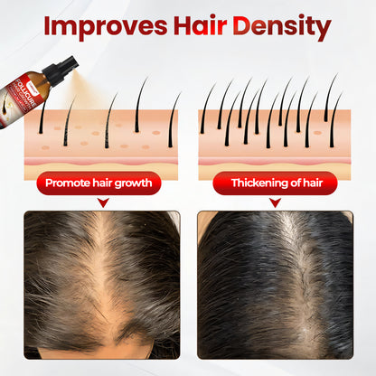 ❤️ CVREOZ® FolliCure Hair Growth Premium Serum 🔥 LIMITED OFFER 60%🔥