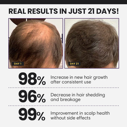 ⭐ CVREOZ® FollicleBoost 5X Hair Growth Serum 🪮