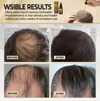 🔥 HOT SALE: 60% OFF 🔥 Cvreoz® Biotin Hair Essential Oil!