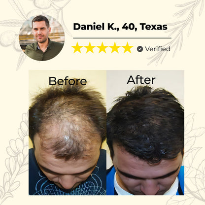 🔥60% OFF TODAY ONLY🔥Cvreoz® Natural Hair Growth Spray